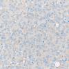 1E2 PA, Pluri (Case 1) 40X PRL rich area GH stain