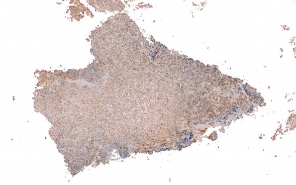 2E1 Pluri (Case 2) FSH 4X