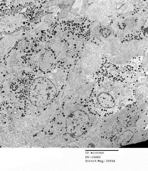 2J1 Pluri (Case 2) EM 007 - Copy