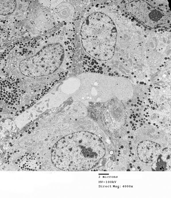 2J2 Pluri (Case 2) EM 011 - Copy