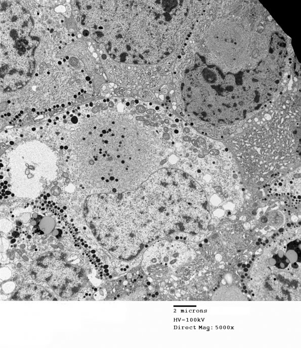 2K1 Pluri (Case 2) M 013 - Copy