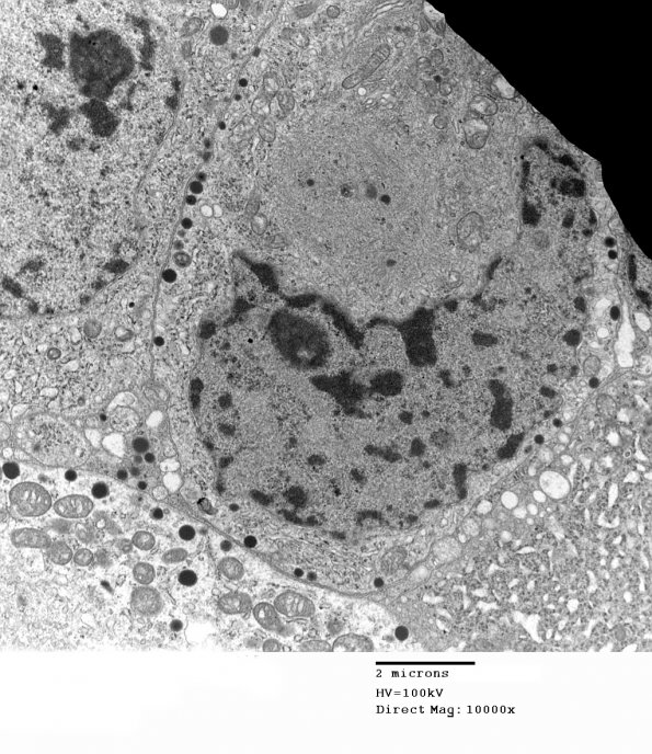 2K3 Pluri (Case 2) EM 015 - Copy