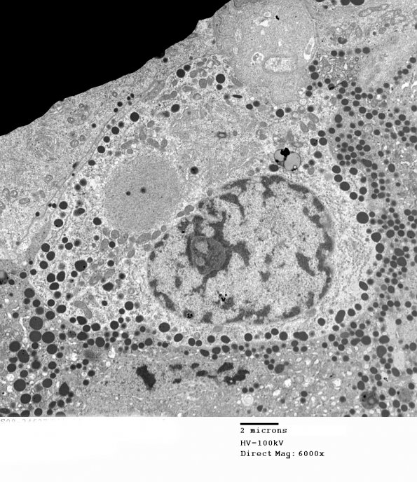 2K6 Pluri (Case 2) EM 041 - Copy