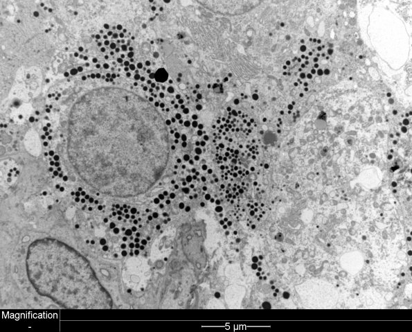 4J2 PA, Pluri (Case 4) EM 1 - Copy