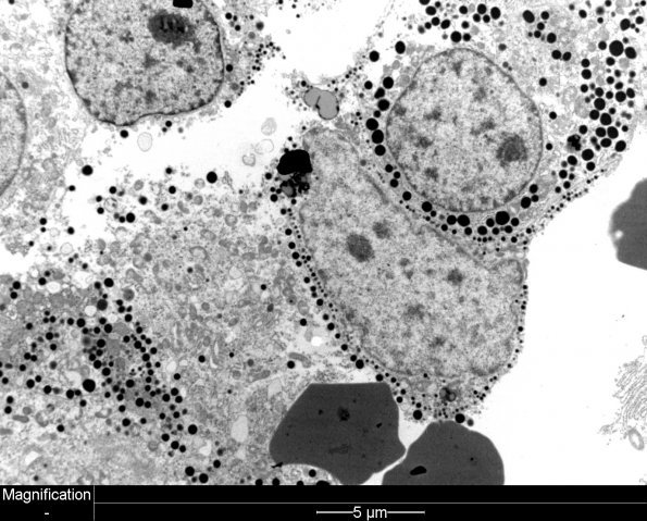 4J3 PA, Pluri (Case 4) EM 2 - Copy