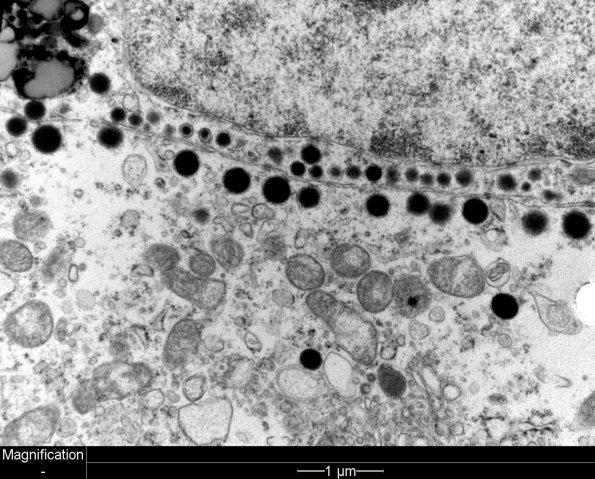 4J4 PA, Pluri (Case 4) EM 3 - Copy