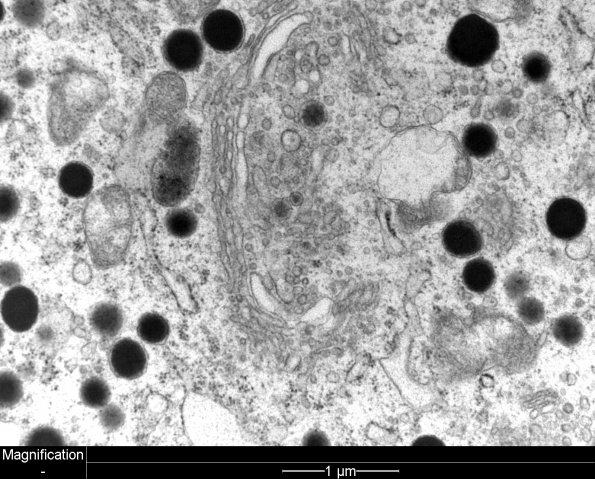 4J5 PA, Pluri (Case 4)  - Copy