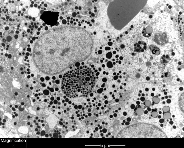 4J6 PA, Pluri (Case 4) - Copy