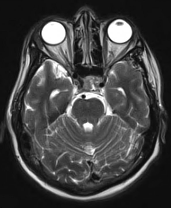 8A4 PA & GGL diffn (Case 8) T2 1 - Copy - Copy