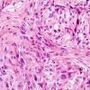 4B5 Spindle cell oncocytoma (Case 4) H&E 8