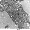 2F6 Perineurioma (Case 2) EM 032 - Copy