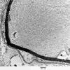 7I3 Perineurioma (Case 7) EM 22a - Copy