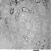 9H6 Perineurioma (Case 9) EM 020 - Copy