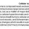 0A Schwannoma - Cellular - Text