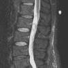 3A1 (Case 3) STIR - Copy