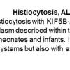 0A ALK-positive Histiocytosis - Text