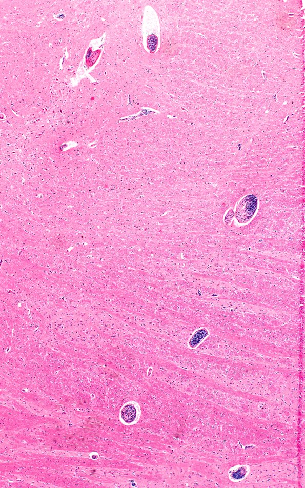 1C3A (Case 1) A 4X 2