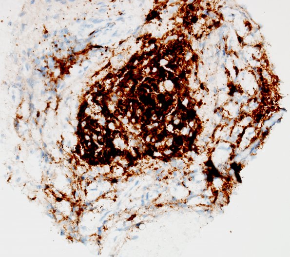 10E LCH (Case 10) CD1a 1.jpg