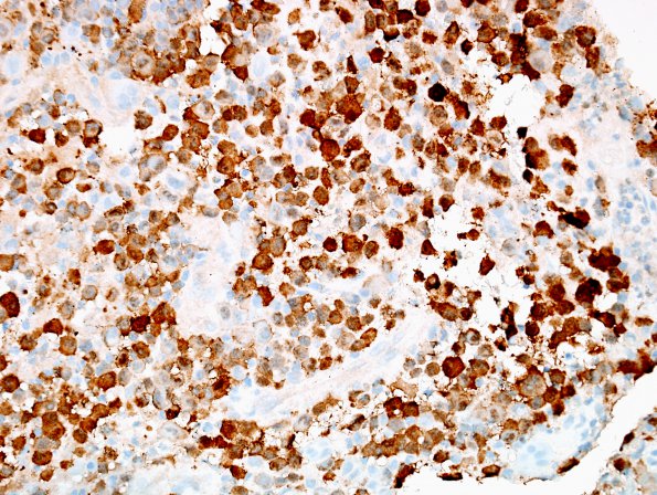 19E1 LCH (Case 19) S100 1.jpg