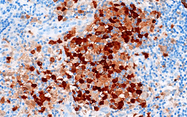 24E3 LCH (Case 24) S100 40X 1