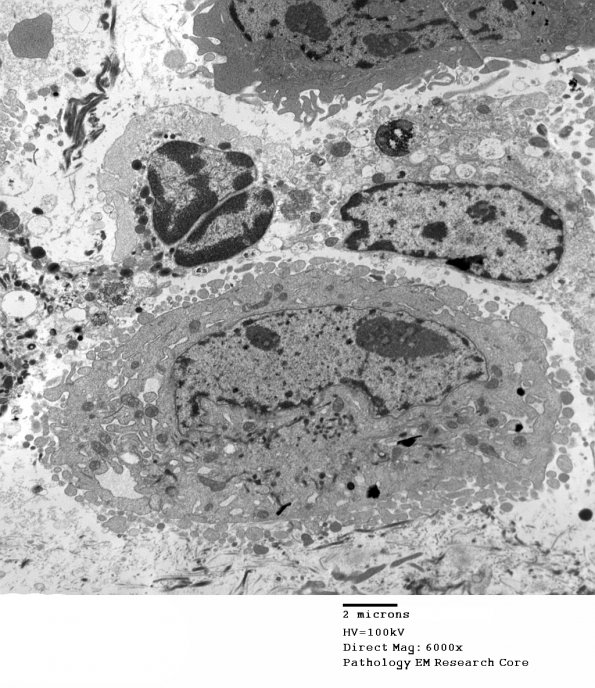 7A1 LCH (Case 7)_EM 002 - Copy