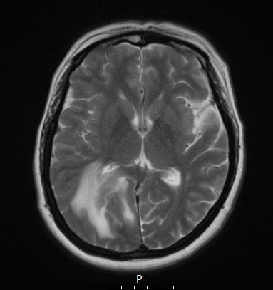 3A (Case 3) T2 2 - Copy - Copy