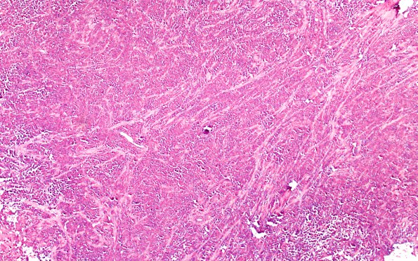 12E4 Plasmacytoma (Case 12) ISH Lambda 10X