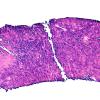 2D1 Plasmacytoma (Case 2) ISH Kappa 10X