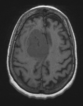 1A0A All 5 (Case 1) T1noC - Copy