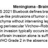 0A Meningioma - Brain Invasion - Text