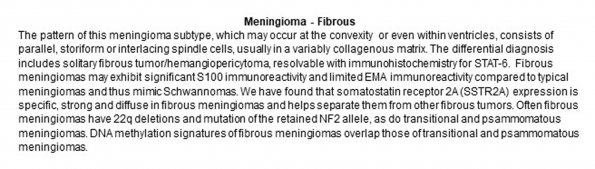 0A Meningioma - Fibrous