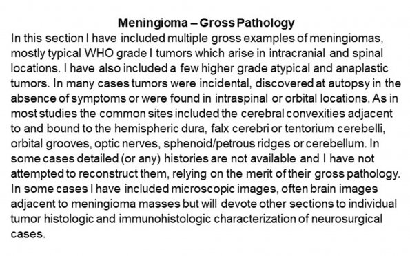 0A Meningioma - Gross Pathology