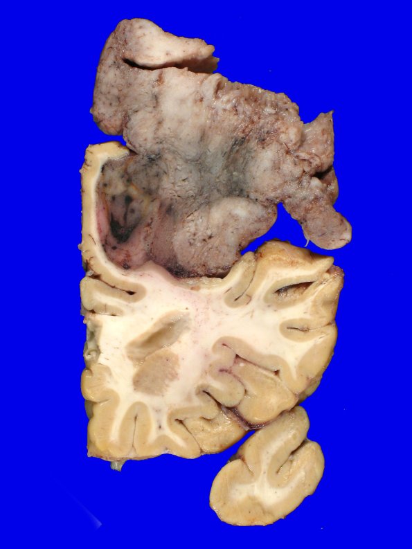 72D4 NCL (A07-109) Gross_15