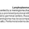 0A Meningioma - Lymphoplasmacyte-Rich - Text