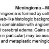 0A Meningioma - Microcystic