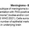 0A Meningioma - Secretory - Text