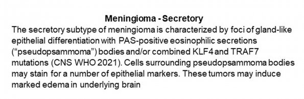 0A Meningioma - Secretory - Text