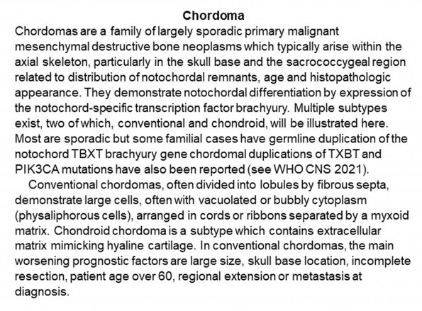 0A Chordoma - Text