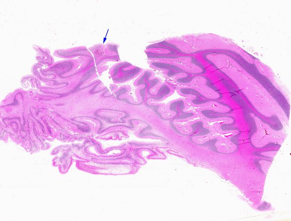 12B7 (Case 12) N13 copy