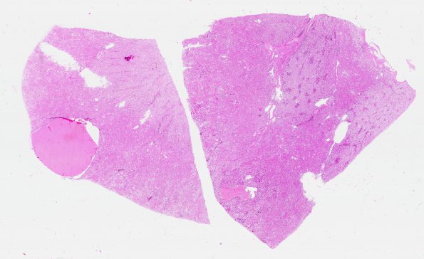 29D2 (Case 29) Renal 4