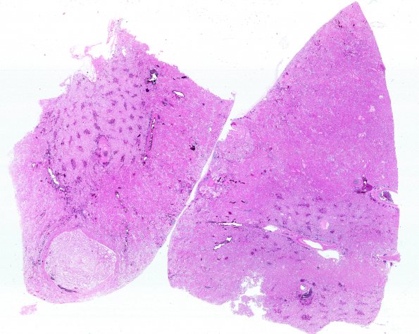 29D4 (Case 29) Renal 2