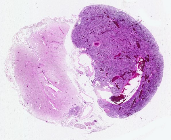 8C3 (Case 8) MidTh N17a