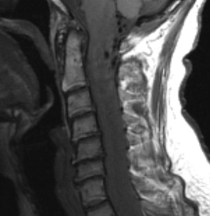 1A2 (S07-41359) T1 noC Crop - Copy