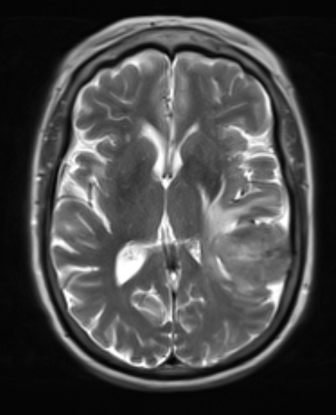 4A2 SFT (Case 4) T2 1 - Copy