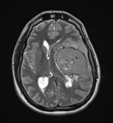 7A3 SFT (Case 7) T2W - Copy