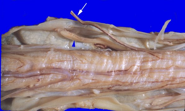 13F ALS (Case 13F) 5 copyA