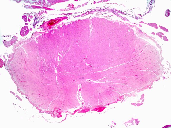 15E1 FTLD-ALS (Case 15) N10 H&E 2X.jpg