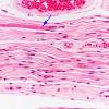 1B8 ALS (Case 1) Ventral root 40X 2 copy