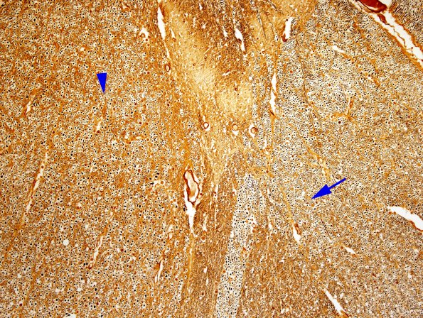 4G2 ALS (Case 4) Thoracic Cord Biels 10X Lat CS-DC (Control) 1