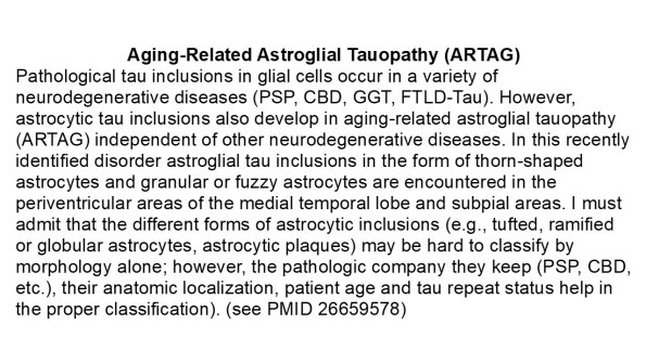 0A Aging-Related Astroglial Tauopathy (ARTAG)